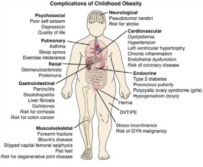 Complications of Childhood Obesity