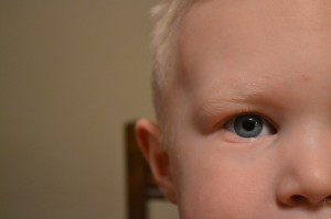 Common Eye Problems in Children